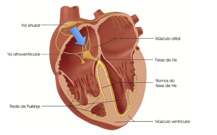 A presença de onda P no ECG quer dizer que o ritmo é sinusal, certo? Errado! Veja os motivos.