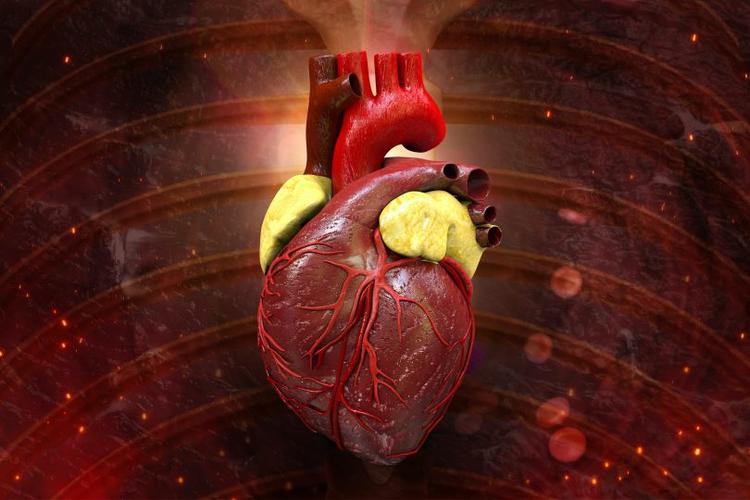 Como classificar a gravidade da estenose aórtica pelo ecocardiograma?